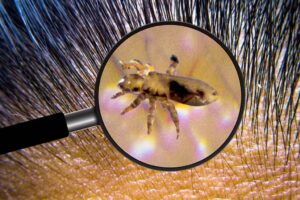 How to Clean House After Lice